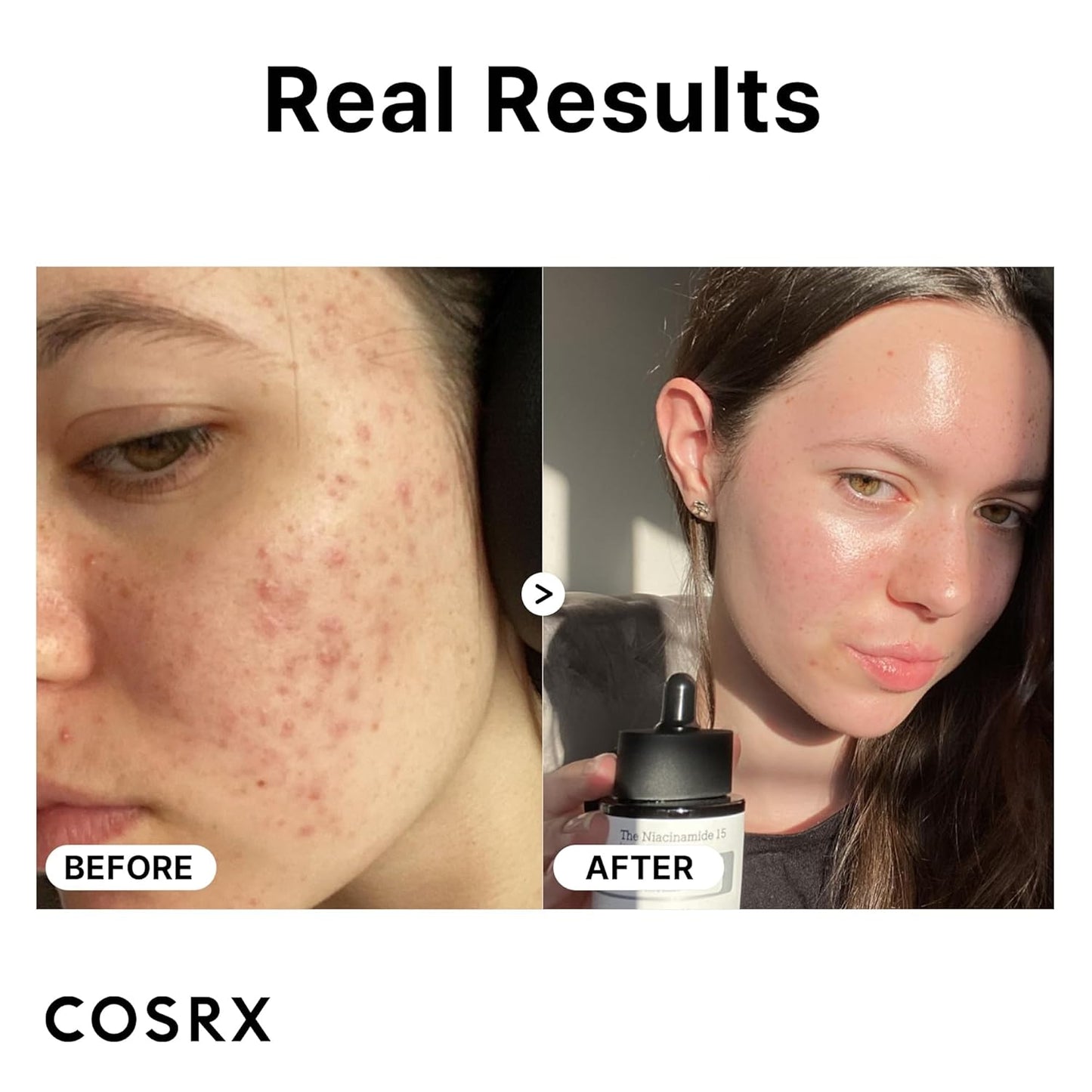 COSRX 15% Niacinamide Face Serum